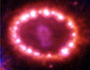 SN1987A Ring
